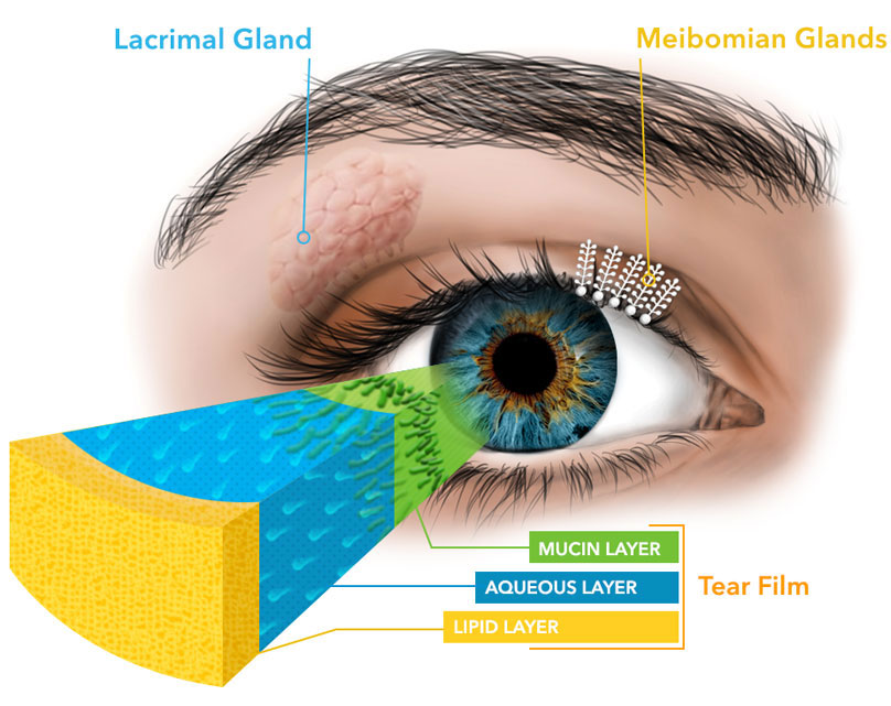 DRY EYE DISEASE (DED)