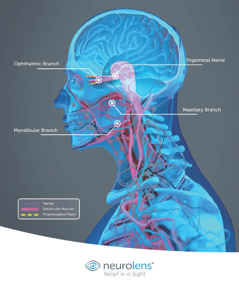 Neurolens how it works illustration